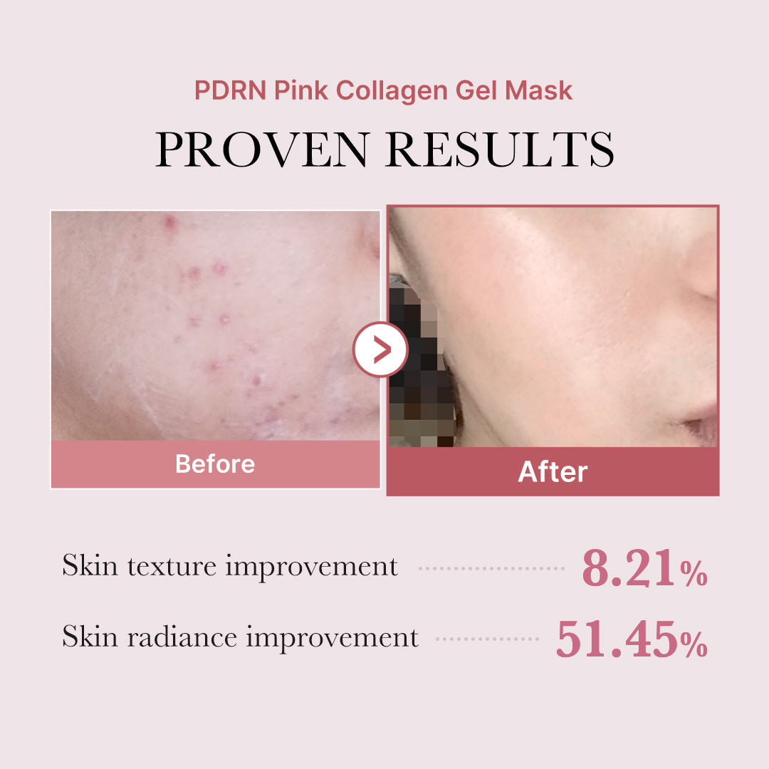 PDRN Pink Glow Full Set | Affordable Glass Glow 7-Day Skincare Set